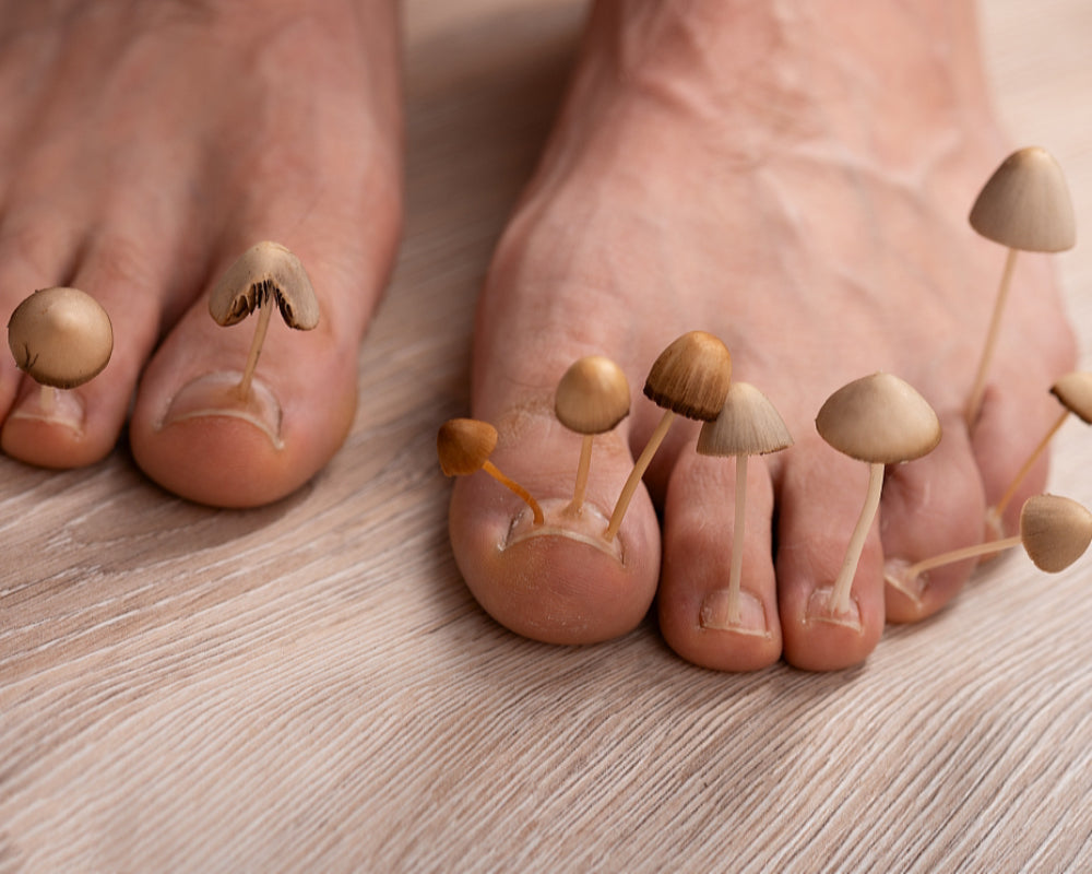 This 7-Minute Laser Therapy Helped Destroy Years of Fungal Infections